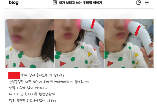 이미지